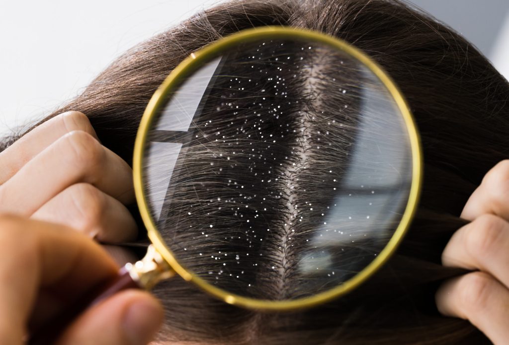 花瓣素材_头发头皮屑_132446454